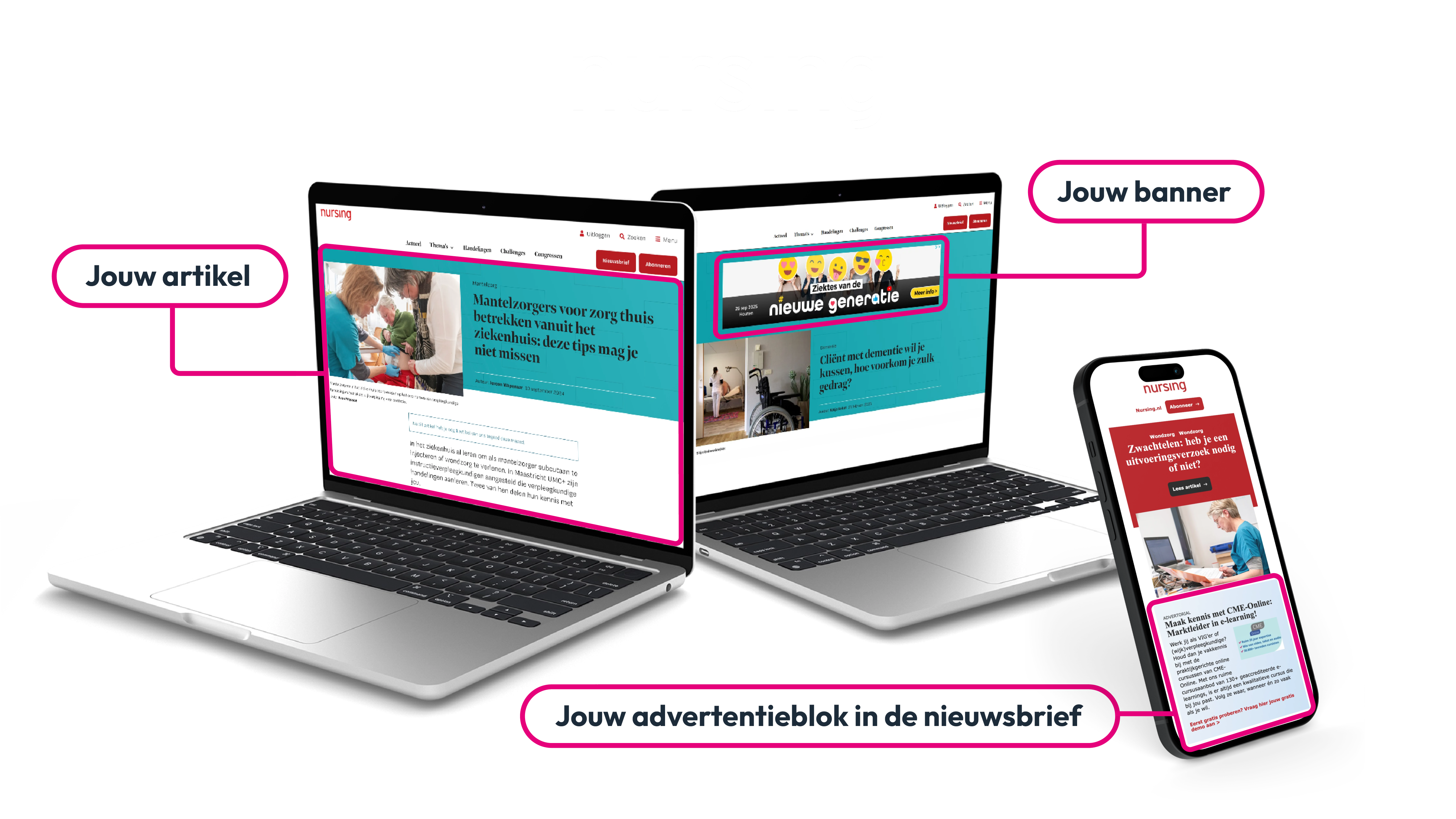 employer branding pakket uitleg